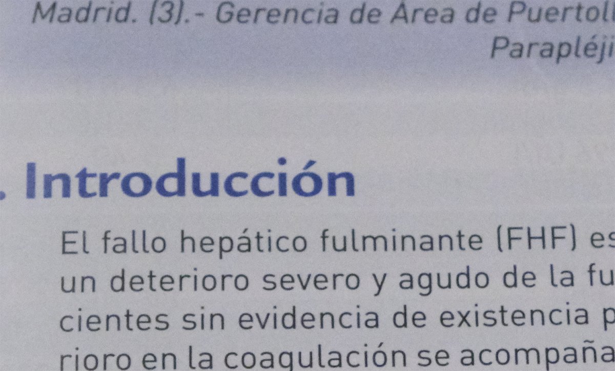 12500-sin tratamiento CO.jpg